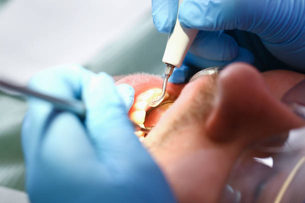 Best Emergency Dental Services for Seniors in Virden, IL